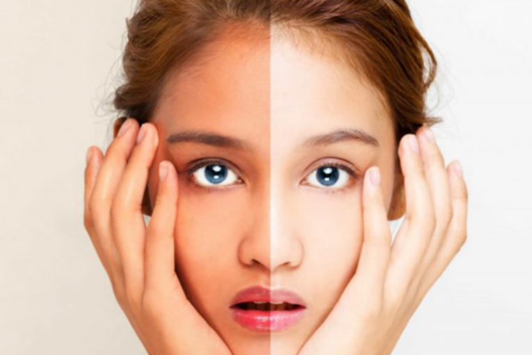 《皮肤科学杂志》补充nad+可显著减少衰老黑色素细胞产生黑色素